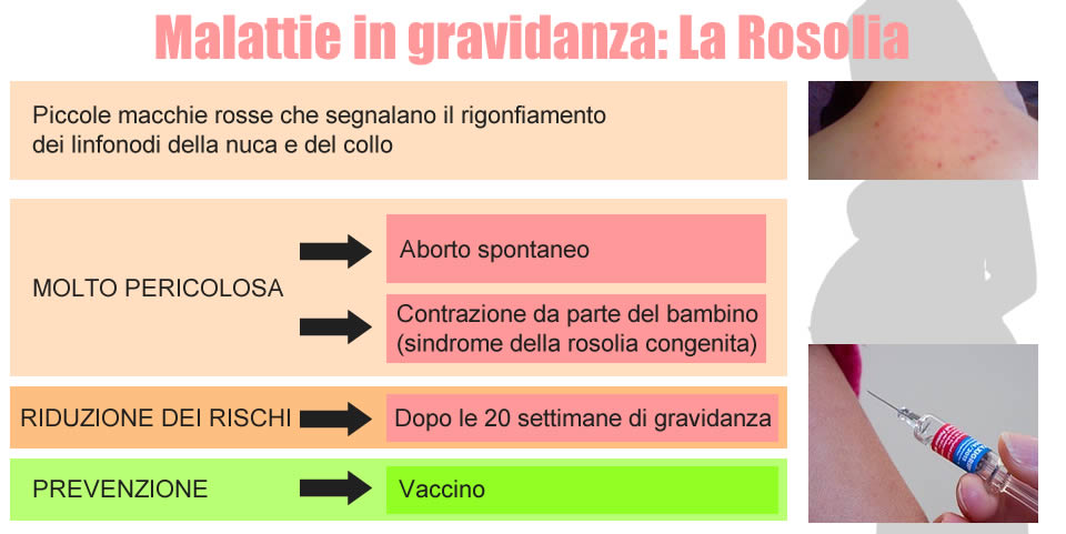 Malattie in gravidanza - Rosolia (tabella riepilogativa)