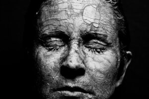 disidratazione